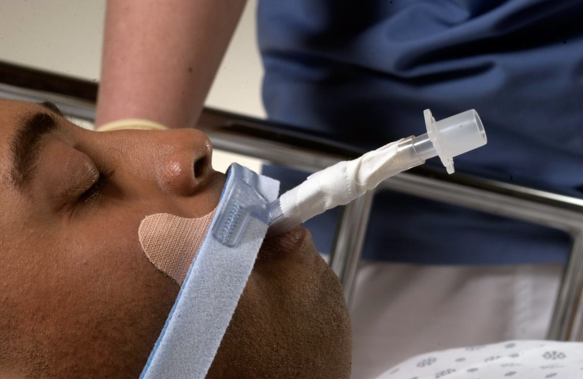 DALE Stabilock Endotracheal Tube Holder - Image 3