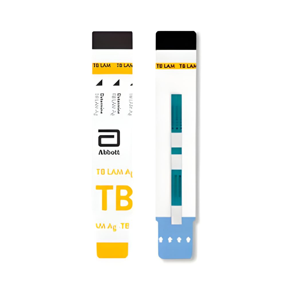 ABBOTT Determine™ TB LAM Ag Leading Medical Distributor in the